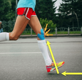 Runner creating knee pain by over-reaching with their legs